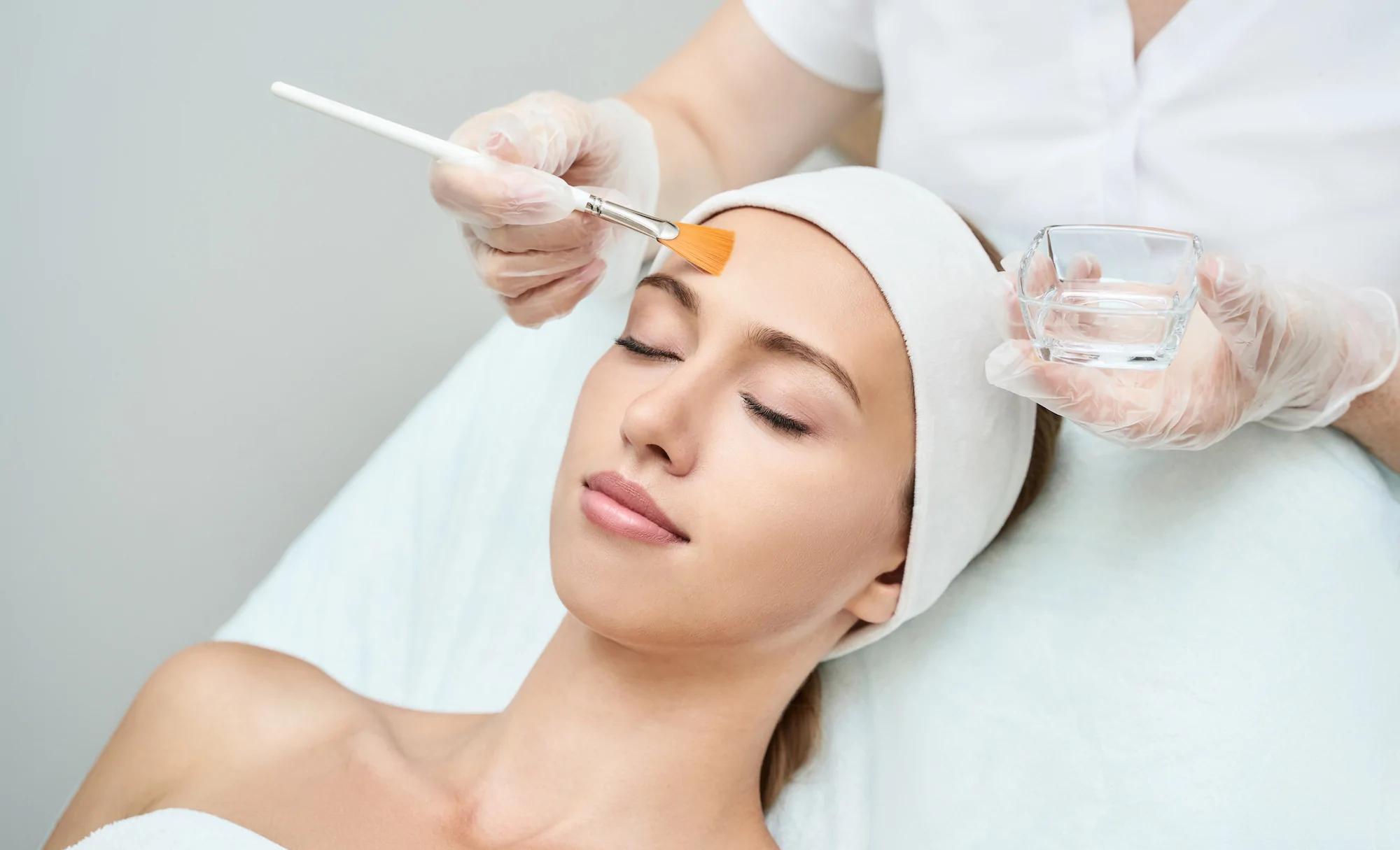 Chemical Peels For Acne | Glow Bright Med Spa